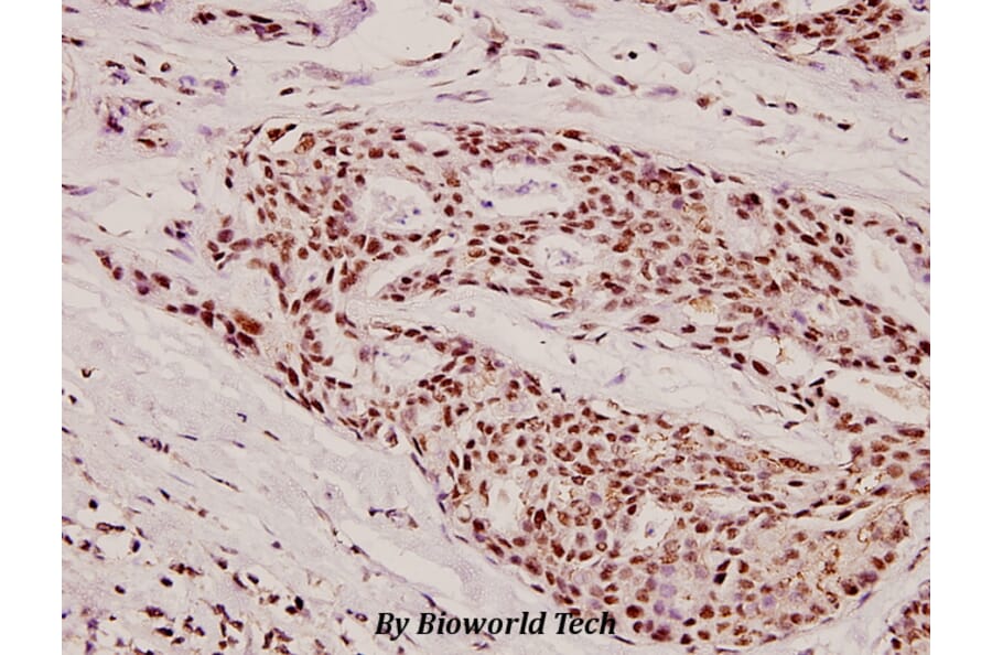 Anti-Fes (K161) Antibody from Bioworld Technology (BS2464) - Antibodies.com