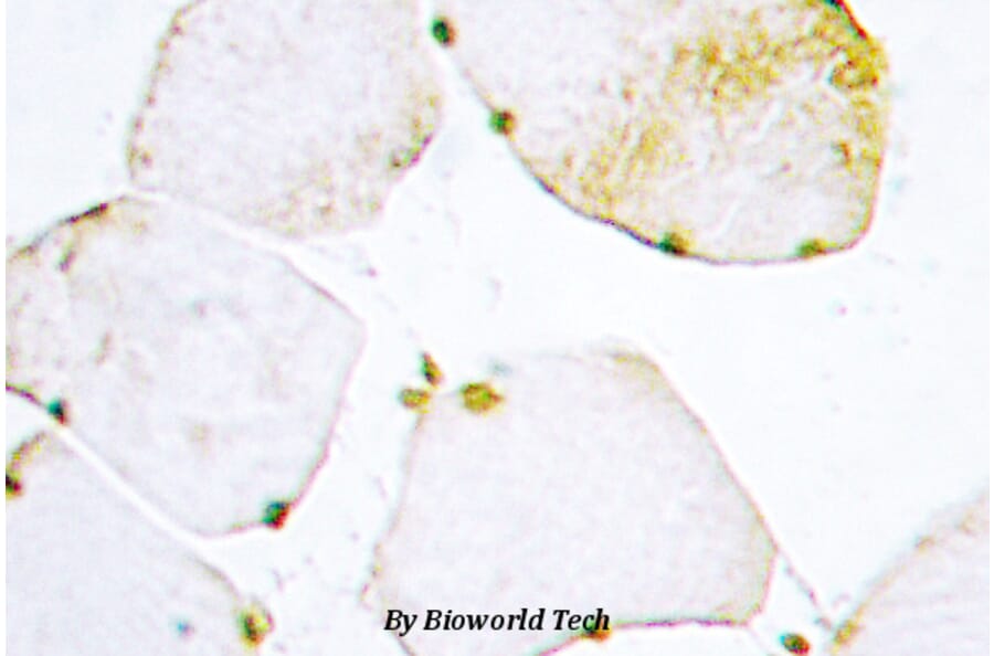Anti-UDG (H221) Antibody from Bioworld Technology (BS2465) - Antibodies.com