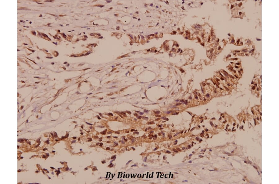 Anti-TCF-3 (N601) Antibody from Bioworld Technology (BS2466) - Antibodies.com