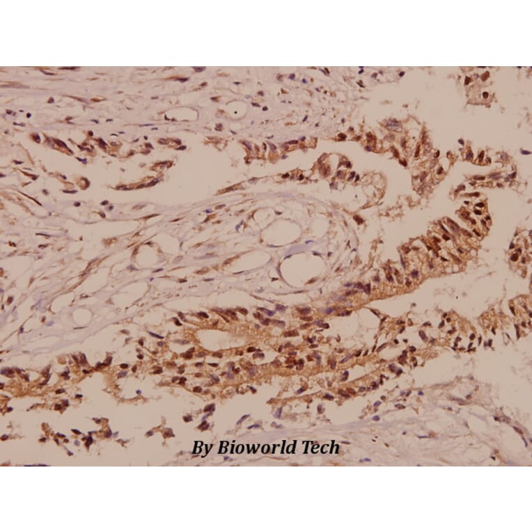Anti-TCF-3 (N601) Antibody from Bioworld Technology (BS2466) - Antibodies.com