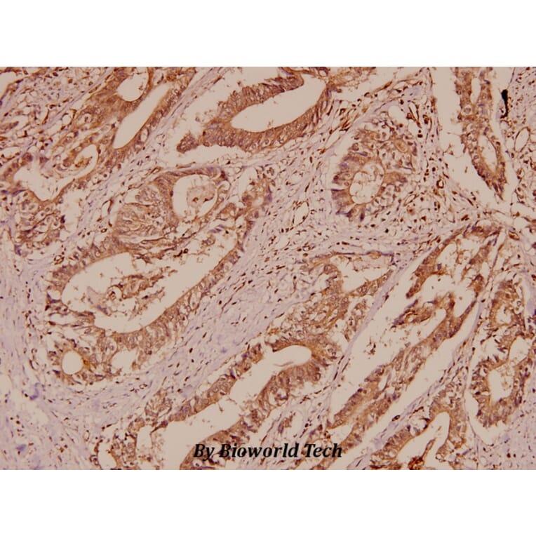 Anti-BSG / EMMPRIN (Q370) Antibody from Bioworld Technology (BS2472) - Antibodies.com