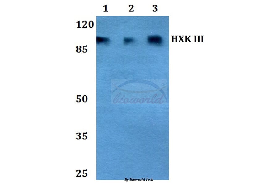 Anti-HXK III (V848) Antibody from Bioworld Technology (BS2477) - Antibodies.com