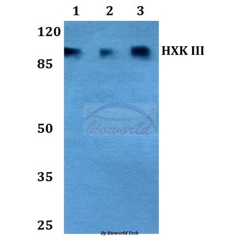 Anti-HXK III (V848) Antibody from Bioworld Technology (BS2477) - Antibodies.com