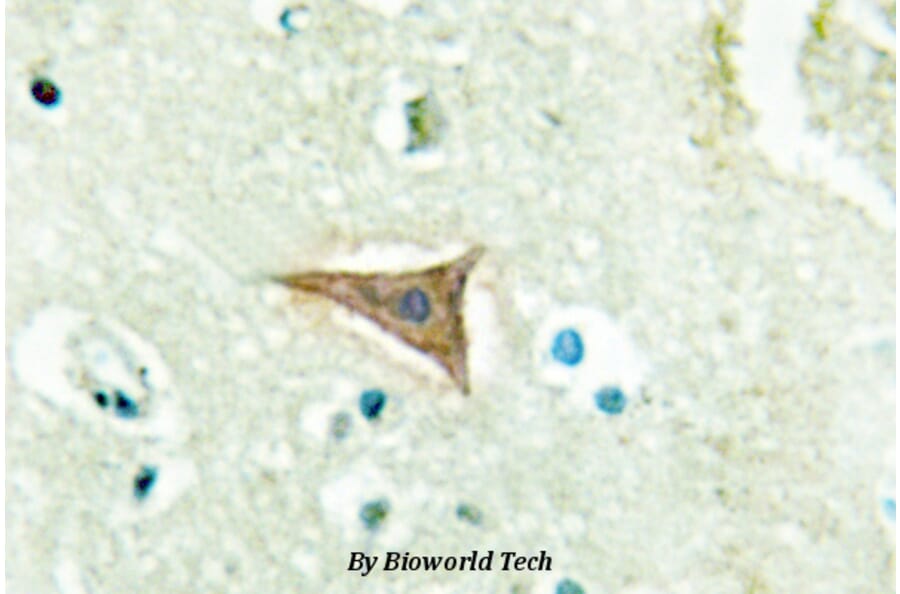 Anti-Ephrin-A5 (P63) Antibody from Bioworld Technology (BS2478) - Antibodies.com