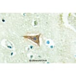 Anti-Ephrin-A5 (P63) Antibody from Bioworld Technology (BS2478) - Antibodies.com