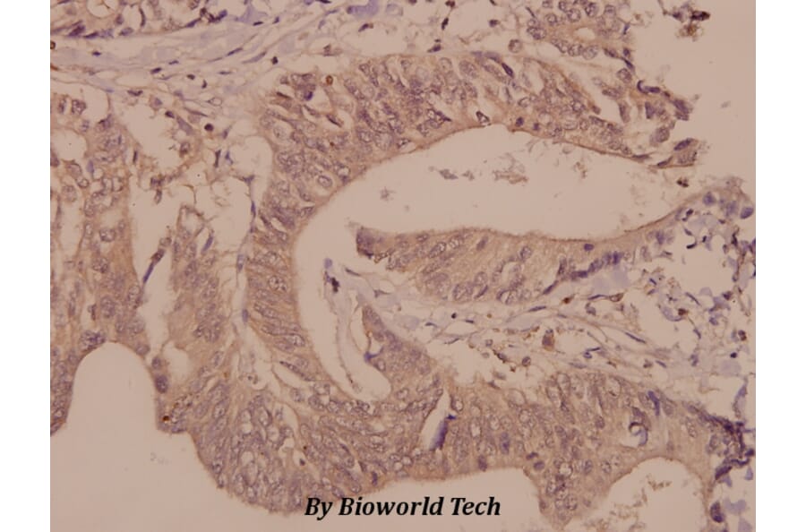 Anti-DGK-θ (S725) Antibody from Bioworld Technology (BS2479) - Antibodies.com