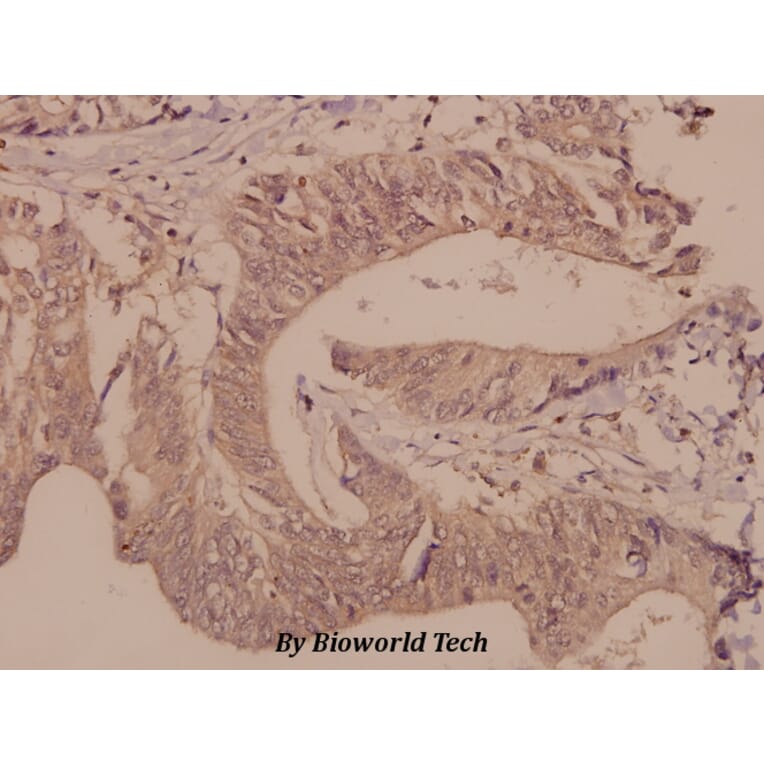 Anti-DGK-θ (S725) Antibody from Bioworld Technology (BS2479) - Antibodies.com