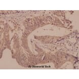 Anti-DGK-θ (S725) Antibody from Bioworld Technology (BS2479) - Antibodies.com