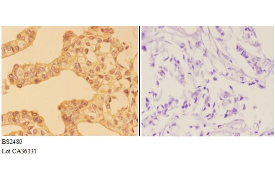 Anti-AMPKγ1/2/3 (K78) Antibody from Bioworld Technology (BS2480) - Antibodies.com