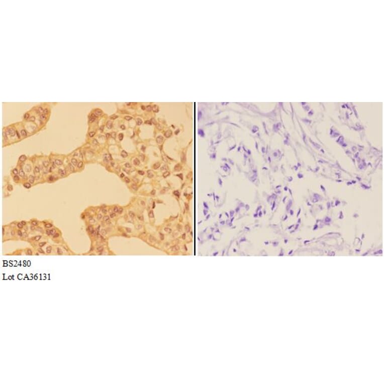 Anti-AMPKγ1/2/3 (K78) Antibody from Bioworld Technology (BS2480) - Antibodies.com