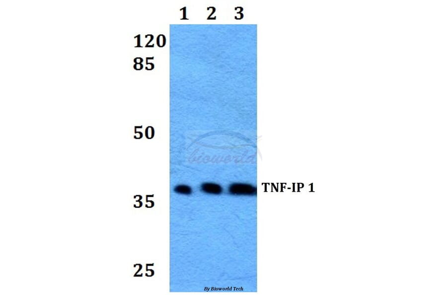 Anti-TNF-IP 1 (S122) Antibody from Bioworld Technology (BS2484) - Antibodies.com