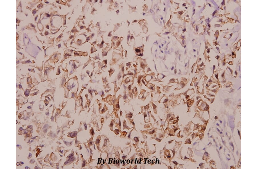 Anti-TNF-IP 1 (S122) Antibody from Bioworld Technology (BS2484) - Antibodies.com