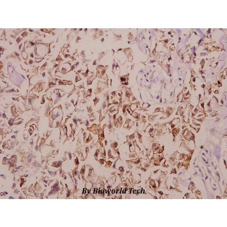 Anti-TNF-IP 1 (S122) Antibody from Bioworld Technology (BS2484) - Antibodies.com