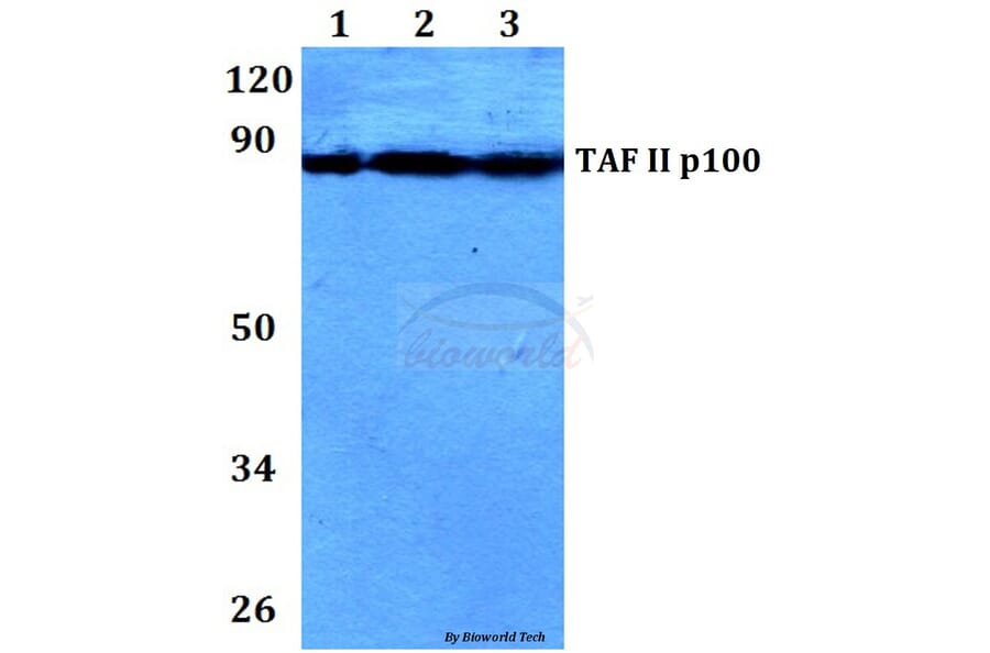 Anti-TAF II p100 (G411) Antibody from Bioworld Technology (BS2485) - Antibodies.com