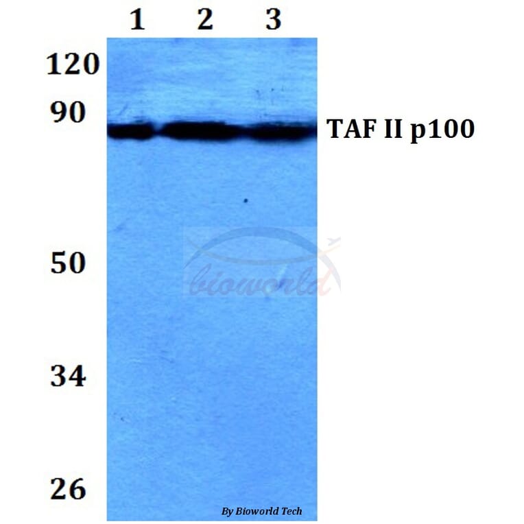 Anti-TAF II p100 (G411) Antibody from Bioworld Technology (BS2485) - Antibodies.com