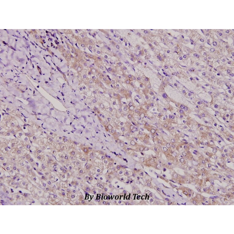 Anti-TAF II p100 (G411) Antibody from Bioworld Technology (BS2485) - Antibodies.com