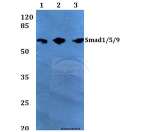 Anti-Smad1/5/9 (Q22) Antibody from Bioworld Technology (BS2486) - Antibodies.com