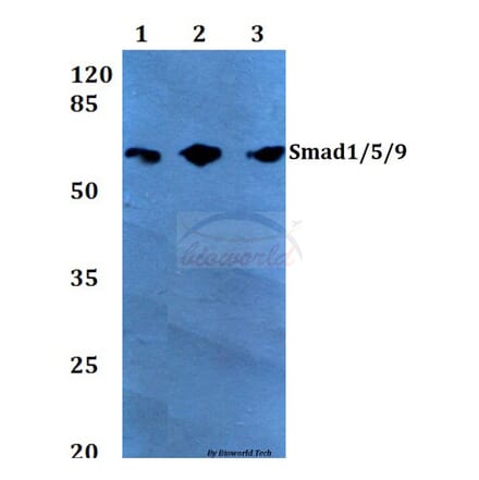Anti-Smad1/5/9 (Q22) Antibody from Bioworld Technology (BS2486) - Antibodies.com
