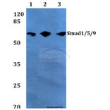 Anti-Smad1/5/9 (Q22) Antibody from Bioworld Technology (BS2486) - Antibodies.com