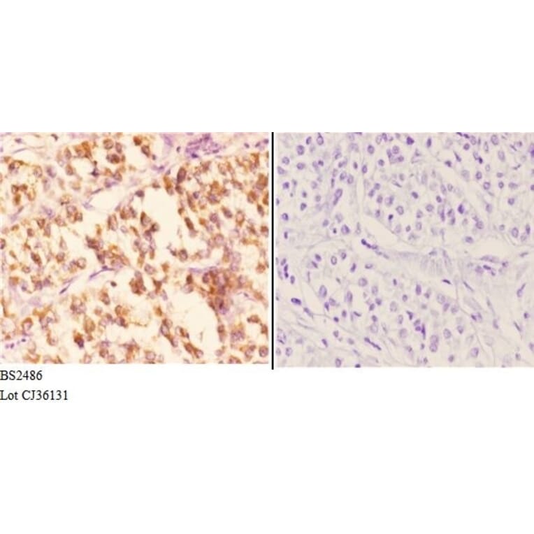 Anti-Smad1/5/9 (Q22) Antibody from Bioworld Technology (BS2486) - Antibodies.com