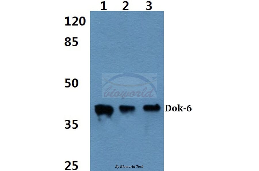 Anti-Dok-6 (G130) Antibody from Bioworld Technology (BS2488) - Antibodies.com