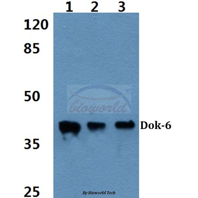 Anti-Dok-6 (G130) Antibody from Bioworld Technology (BS2488) - Antibodies.com