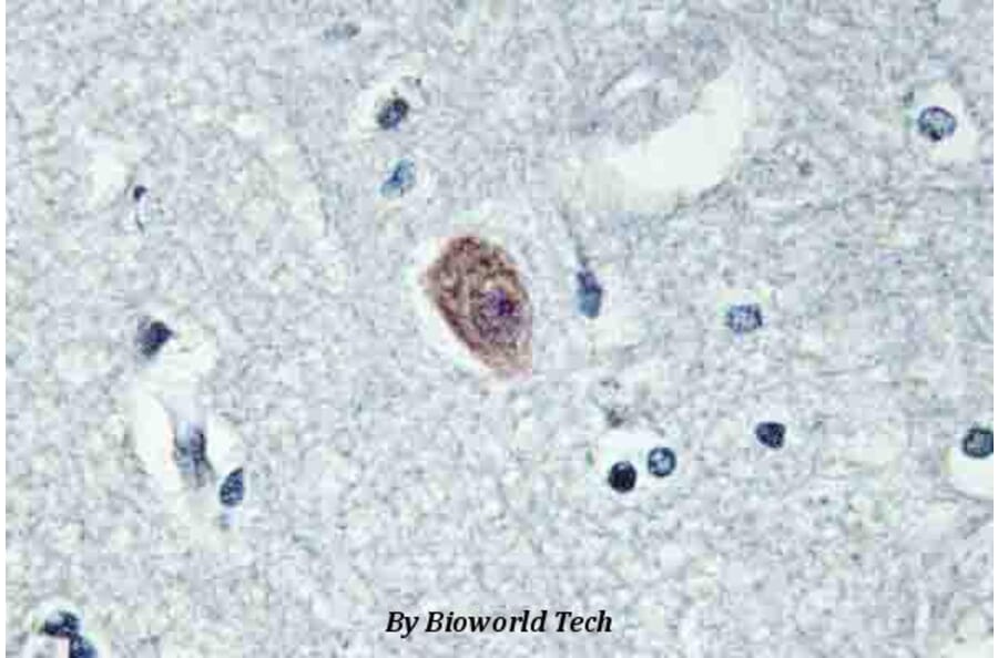 Anti-Dok-6 (G130) Antibody from Bioworld Technology (BS2488) - Antibodies.com