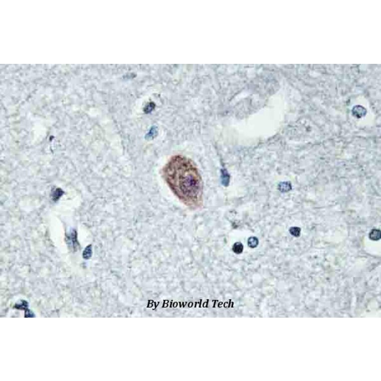Anti-Dok-6 (G130) Antibody from Bioworld Technology (BS2488) - Antibodies.com