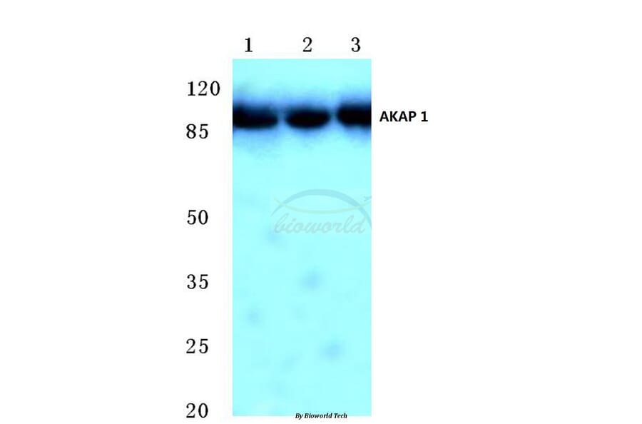 Anti-AKAP 1 (N306) Antibody from Bioworld Technology (BS2498) - Antibodies.com