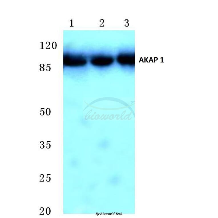 Anti-AKAP 1 (N306) Antibody from Bioworld Technology (BS2498) - Antibodies.com