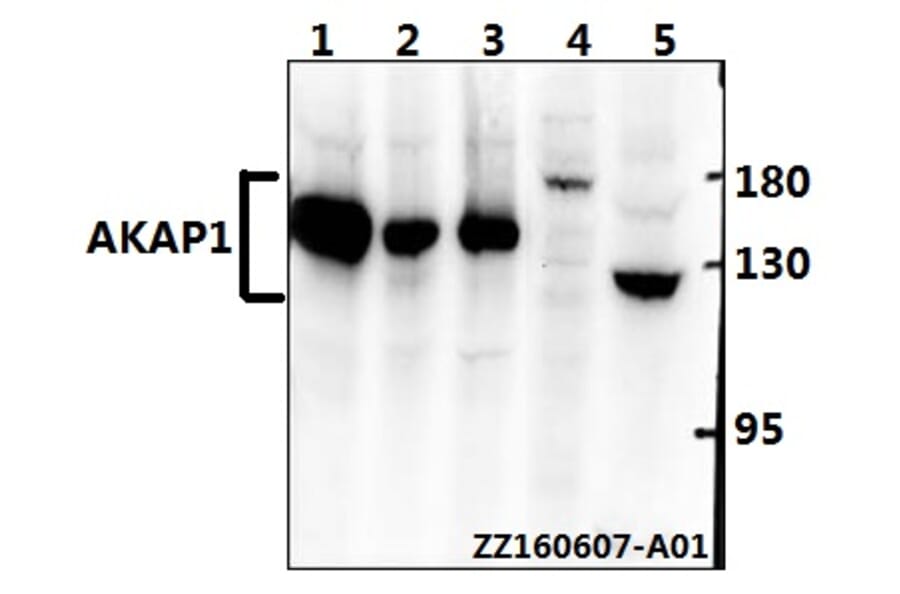 Anti-AKAP 1 (N306) Antibody from Bioworld Technology (BS2498) - Antibodies.com