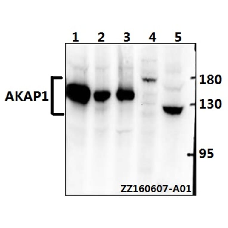 Anti-AKAP 1 (N306) Antibody from Bioworld Technology (BS2498) - Antibodies.com