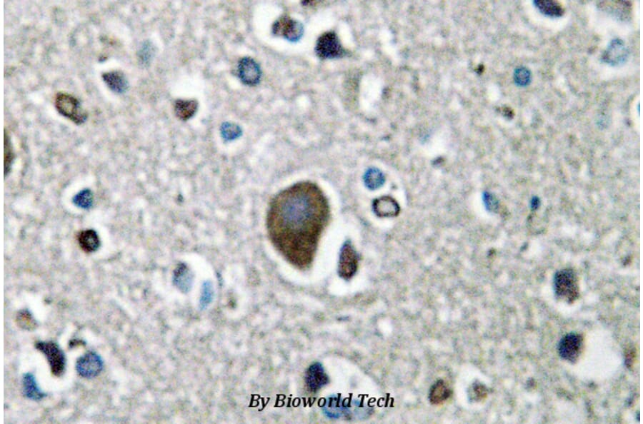 Anti-AKAP 1 (N306) Antibody from Bioworld Technology (BS2498) - Antibodies.com