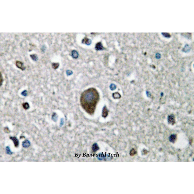 Anti-AKAP 1 (N306) Antibody from Bioworld Technology (BS2498) - Antibodies.com