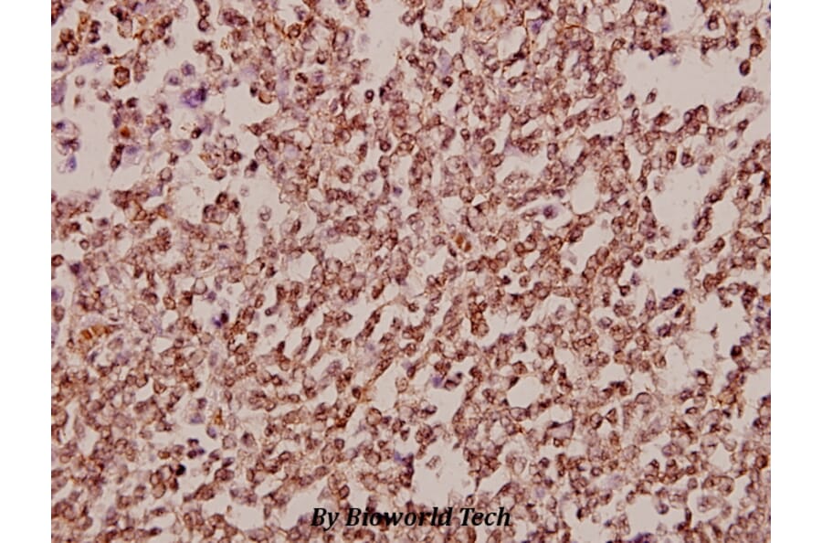 Anti-TAF II p68 (N380) Antibody from Bioworld Technology (BS2499) - Antibodies.com