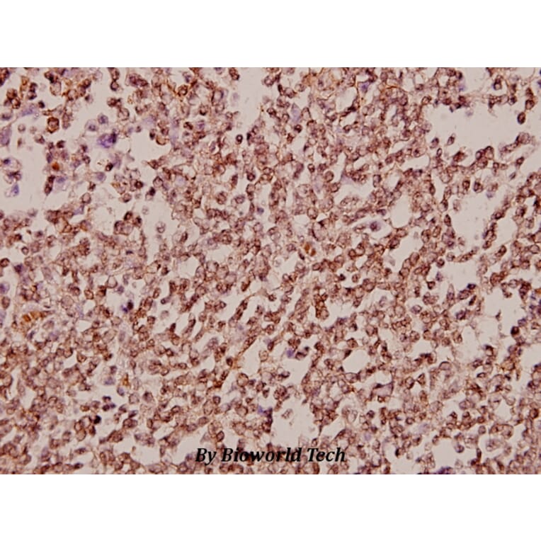 Anti-TAF II p68 (N380) Antibody from Bioworld Technology (BS2499) - Antibodies.com