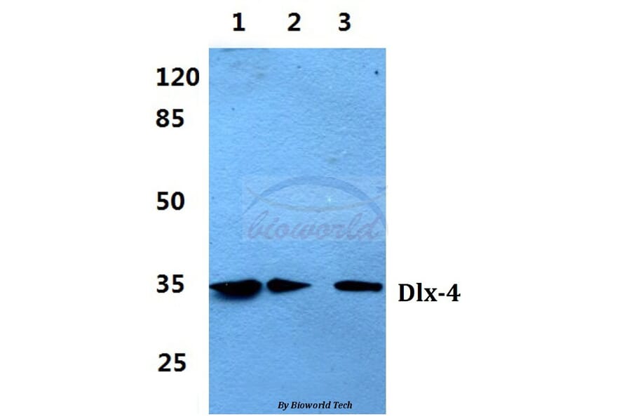 Anti-Dlx-4 (Q90) Antibody from Bioworld Technology (BS2500) - Antibodies.com