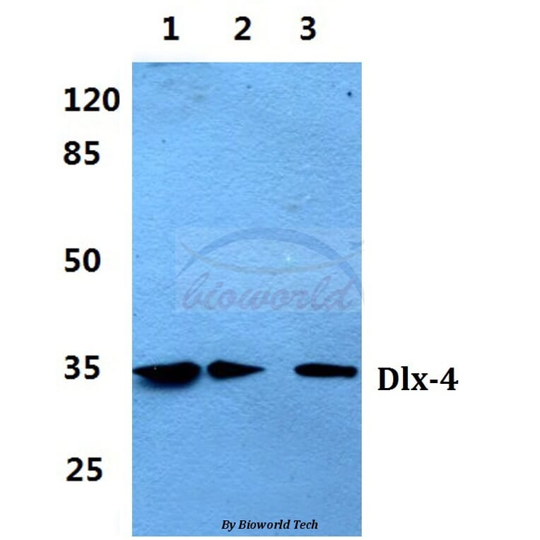 Anti-Dlx-4 (Q90) Antibody from Bioworld Technology (BS2500) - Antibodies.com