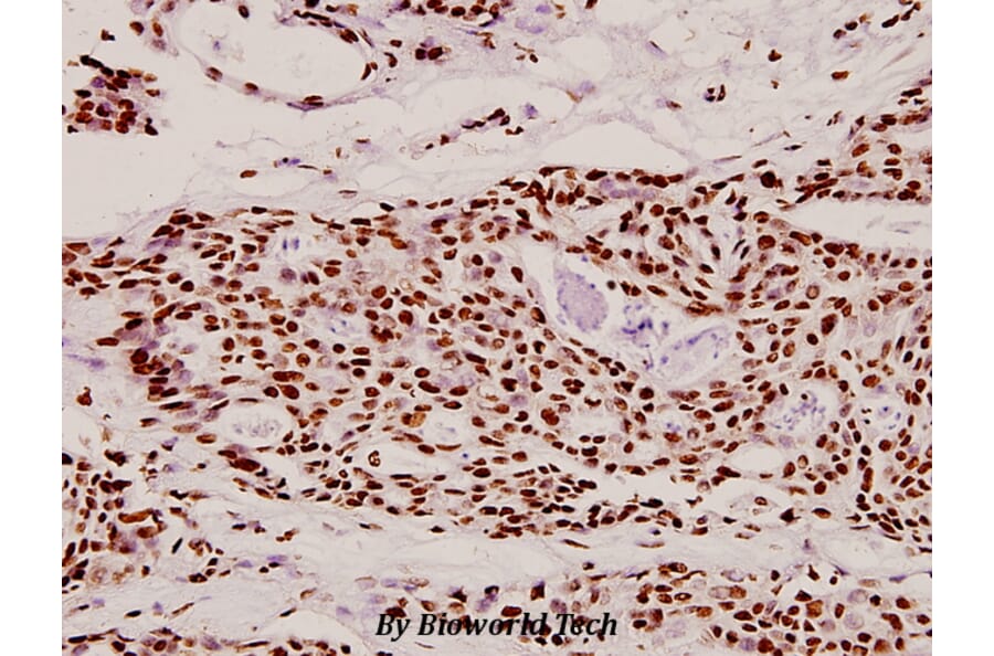 Anti-Dlx-4 (Q90) Antibody from Bioworld Technology (BS2500) - Antibodies.com