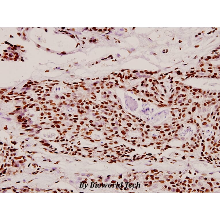 Anti-Dlx-4 (Q90) Antibody from Bioworld Technology (BS2500) - Antibodies.com