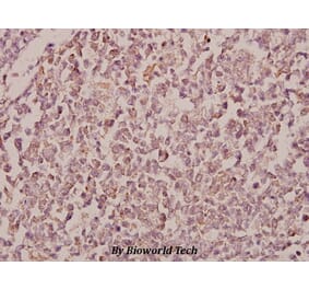 Anti-RhoBTB1/2 (T85) Antibody from Bioworld Technology (BS2503) - Antibodies.com