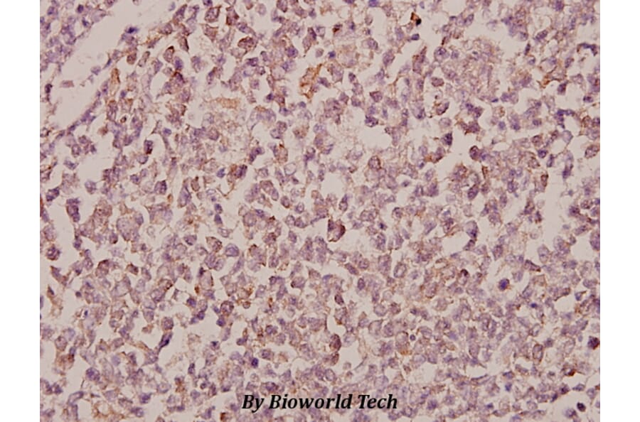 Anti-RhoBTB1/2 (T85) Antibody from Bioworld Technology (BS2503) - Antibodies.com