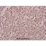 Anti-RhoBTB1/2 (T85) Antibody from Bioworld Technology (BS2503) - Antibodies.com