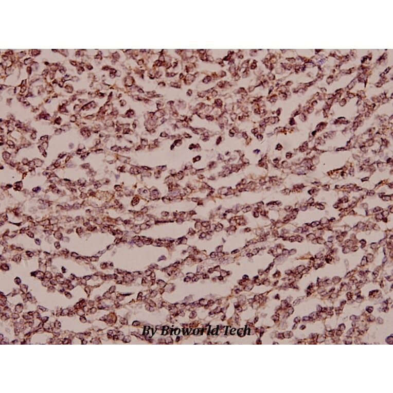 Anti-Endo180 (G145) Antibody from Bioworld Technology (BS2506) - Antibodies.com