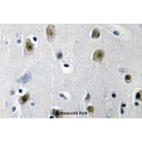 Anti-ZBP-89 (E84) Antibody from Bioworld Technology (BS2510) - Antibodies.com