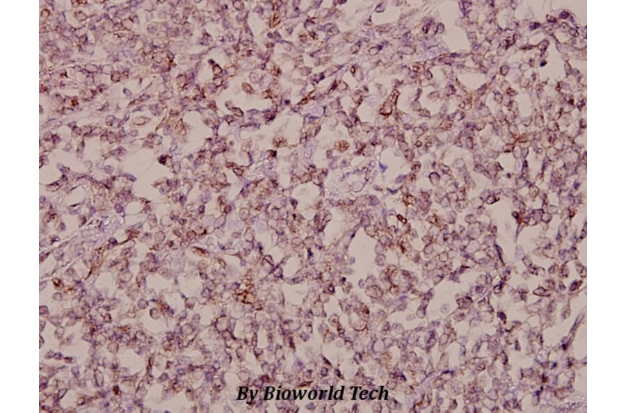 Anti-Stonin-1 (W718) Antibody from Bioworld Technology (BS2511) - Antibodies.com