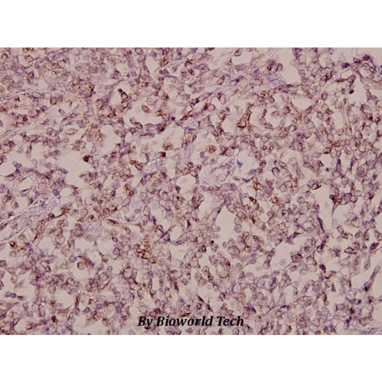 Anti-Stonin-1 (W718) Antibody from Bioworld Technology (BS2511) - Antibodies.com