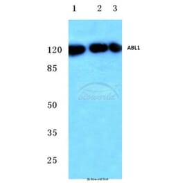 Anti-ABL1 (E883) Antibody from Bioworld Technology (BS2513) - Antibodies.com
