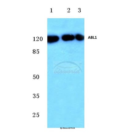 Anti-ABL1 (E883) Antibody from Bioworld Technology (BS2513) - Antibodies.com