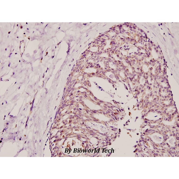 Anti-Cox-17 (N8) Antibody from Bioworld Technology (BS2514) - Antibodies.com
